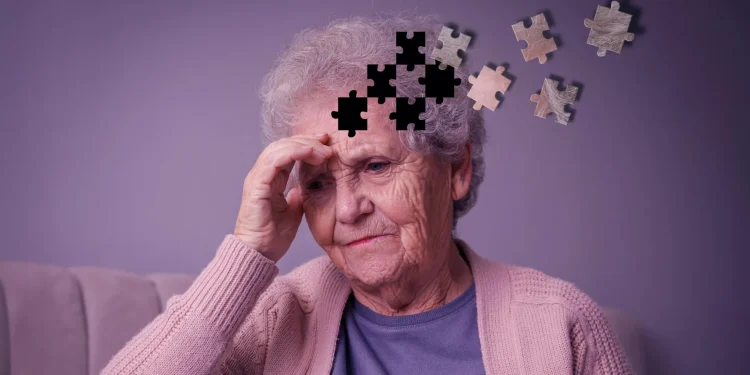 Oestrogeentherapie gekoppeld aan minder tekenen van alzheimer